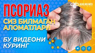 ПСОРИАЗнинг  СИЗ БИЛМАГАН АЛОМАТЛАРИ. ВИДЕО КЎРИНГ. #saidatabiba  #asalarimed #psoriasis