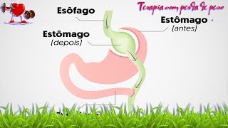 Saúde -   Bypass gástrico: o que é, como é feito, recuperação e complicações