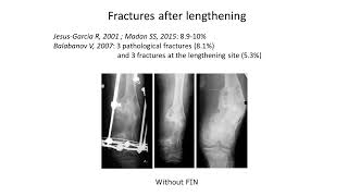 Limb Lengthening and deformity correction in children with abnormal bones