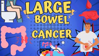 Large Bowel  Cancer -Risk Factors, Symptoms, Diagnosis, And Treatment