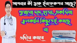 Catzol-M miconazole cream full review in bangla, uses, price, dosage