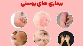 درمان بیماری های جلدی | دلیل جوش صورت | درمان چین و چروک صورت | خشکی جلد | جلد چرب 👨‍⚕️ داکترستان