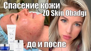 Система ухода Zein Obagi /Уход за кожей / Стоит ли своих денег? Косметика Обаджи