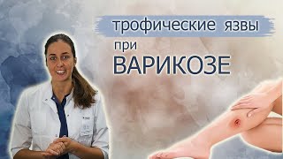 Трофическая язва нижних конечностей. Эффективное лечение.