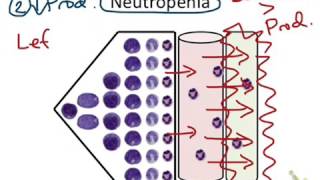 Neutropenia