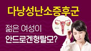 다낭성난소증후군과 여성탈모. 젊은 여성의 안드로겐형 탈모는 다낭성난소증후군 의심~!