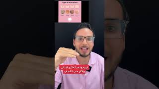 كريم واحد لعلاج ندبات وآثار حب الشباب؟؟  #shorts