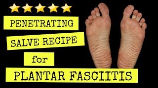 The Best Plantar Fasciitis Pain Relief Salve Recipe You Can Make at Home