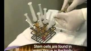 Dr Newman StemCell สเต็มเซลล์ กับผิวหน้า   YouTube