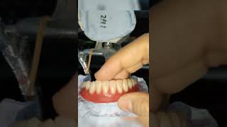 WDC_FULL DENTURE RB | REMOVABLE DENTURE  #dentist #smile #wdc #shorts #prosthodontics