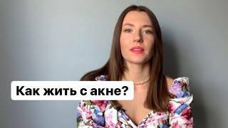 Как же жить с акне и угревой болезнью? Когда лечение получили, как выстоять этот период?