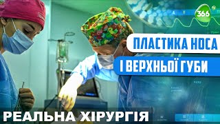 Пластика Носа і Верхньої Губи. Вроджена Вада Носа та Губи. Пластична Хірургія.