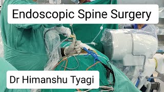 Endoscopic Spine Surgery (Lumbar Slip Disc Surgery/disc prolapse operation)