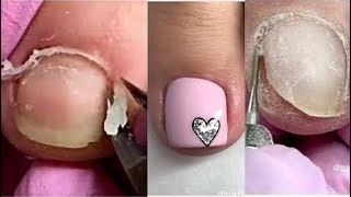 Amazing Toenails Transformations 💄😱Nail Art Designs Compilation 201  | Makeup Compilation Instagram