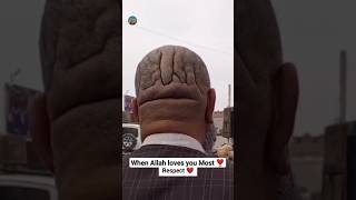 When Allah Love U Most Respect #viral #youtubeshorts #shortsfeed #shorts