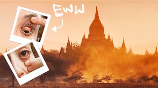 EYE INFECTION?! Searching for Bagan's Best Views