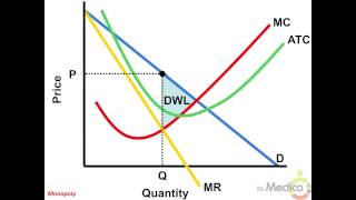 Monopoly - What You Must Know in 5 Minutes - Microeconomics