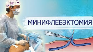 Минифлебэктомия. Варикоз ног, варикоз рук, варикоз промежности - лечение.