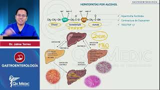 PI24   GASTROENTEROLOGÍA   Hepatopatías por alcohol  Hepatopatías por alcohol