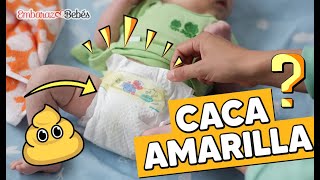 💩🟡 ¿Qué causa la CACA AMARILLA en Bebés? ¿Son normales?