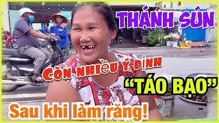 THÁNH SÚN Cà Tím Sẽ Làm Gì Tiếp Theo Sau Khi Đi Làm Răng???