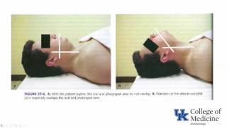 Preoperative Airway Evaluation and Prediction - Dr. Hessel