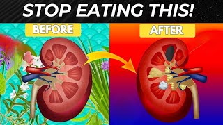 STOP EATING! Top 8 Dangerous Foods that Increase Proteinuria and Destroy your Kidneys