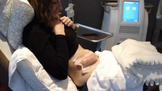 Marouska - Coolsculpting Specialist - Removing the Applicator