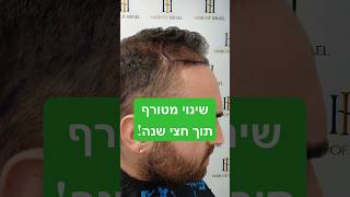 אתם חייבים לראות את השינוי המטורף של אלעד! #השתלתשיערלגברים #גברים #השתלתשיער #ישראל