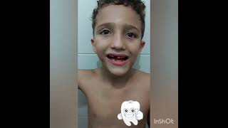 Juninho agora está com a janelinha. #dentes #dentinhos