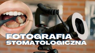 Jaki sprzęt wybrać do fotografii stomatologicznej?