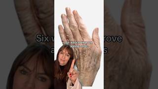 How to reverse ageing hands ⬆️ #ageinghands #antiageing #skincarecommunity