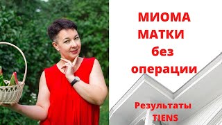 Миома матки без операции. Отзывы Тяньши