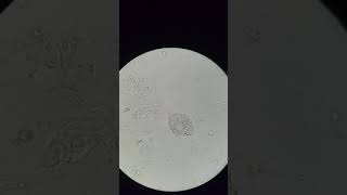 البلهارسيا في البول # الميراسيديوم بعد الفقس ..بلهارسيا بولية Egg  of schistosoma heamatibium