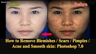 How to Remove Blemishes/Scars/Pimples/Acne and Smooth skin : Adobe Photoshop 7.0