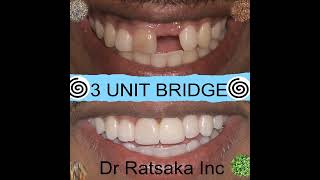 Dr Ratsaka Dental Surgeon