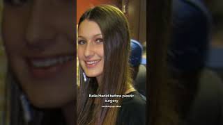 bella hadid before plastic surgery #bellahadid #hadid #model #modeling # #celebrity #fashion