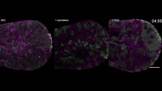 How unfit cells are extruded from epithelial tissues