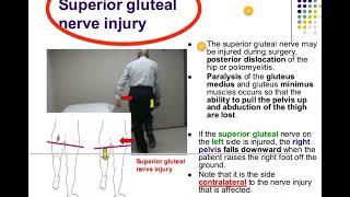 gluteal nerve injuries| lower limb anatomy 🦵| fcps part-1 preparation forum|CPSP FAVOURITE QUESTIONs