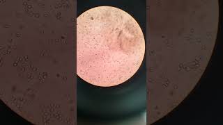 Urine Microscopy #shortsfeed#urine RBC #shortvideo #youtubeshorts #shorts #short