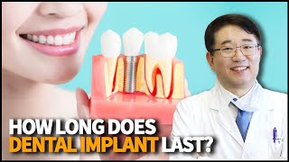 What do you know about Dental Implant? How long does it usually last?