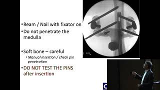 11 Surgical Technique Plates