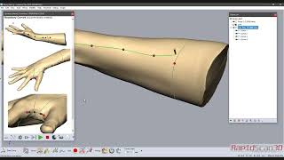 Freeform   Design of Custom Splints for 3D Manufacturing