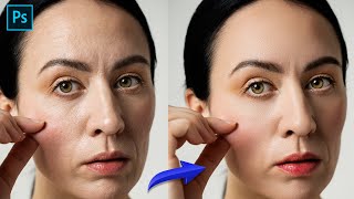 ريتاتش للبشرة وتنظيف وتنعيم بالفوتوشوب | High-End Skin Retouching in Photoshop #Photoshop_tutorial