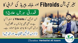 Fibroid in Uterus Treatment | Fibroid Uterus Treatment without Surgery | Fibroids ka herbal ilaj