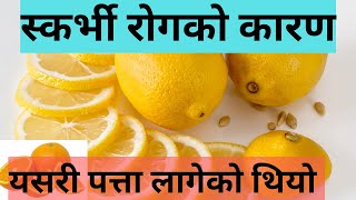 Vitamin c story | James Linds experiment |Scurvy