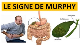 LE SIGNE DE MURPHY