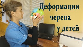 Деформация черепа у детей