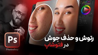 بهترین آموزش رتوش فتوشاپ + حذف جوش صورت