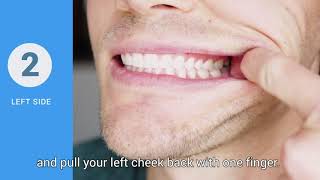 How to take pics of your teeth: Left side